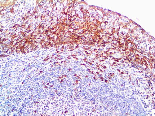 IHC of CD138 on an FFPE Tonsil Tissue